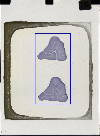 Media type: image; Special Collections 3043   shows specimen_part histological serial section;